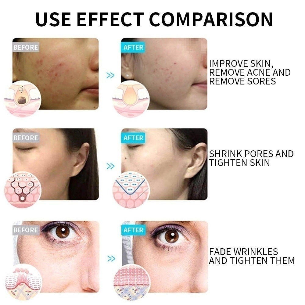 LED Facial Mask Machine – At-Home Spa Treatment for Glowing Skin